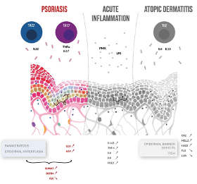 PSORIASIS