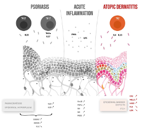 ATOPIC DERMATITIS