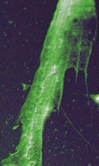 Bio Hd & Vacuum Hd Measurements