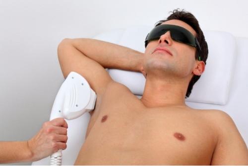 Laser Hair Removal